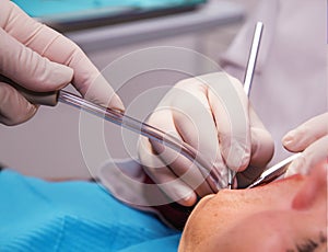 DentistÃ¢â¬â¢s hands with tools making hygiene in a patient`s mouth photo